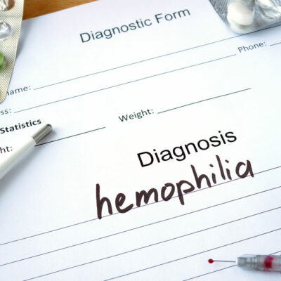 All about hemophilia