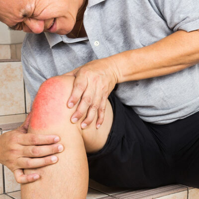 Causes and risk factors of gout to be aware of