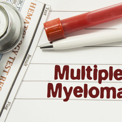 Causes and symptoms of multiple myeloma