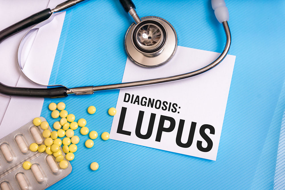 Everything you need to know about lupus