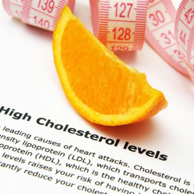 Frequently asked questions about high cholesterol