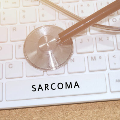 Kaposi’s Sarcoma – Diagnosis and treatment methods
