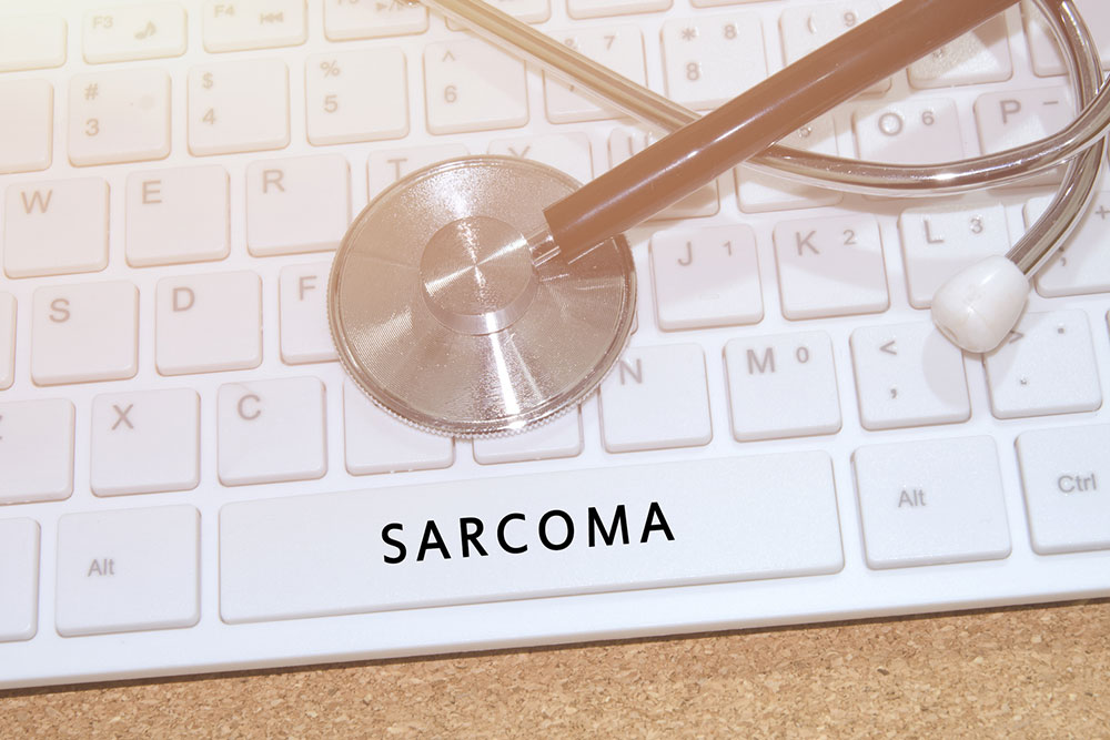 Kaposi’s Sarcoma – Diagnosis and treatment methods