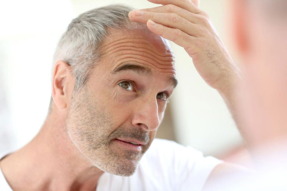 Risk factors, diagnosis and treatment of seborrheic dermatitis