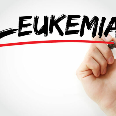 Risk factors and symptoms of leukemia