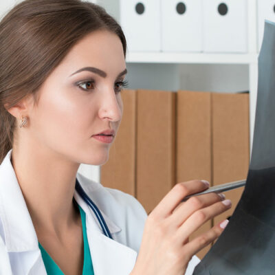 Symptoms and causes of idiopathic pulmonary fibrosis