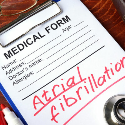 The best treatment options for atrial fibrillation