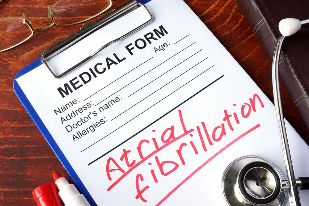 The best treatment options for atrial fibrillation
