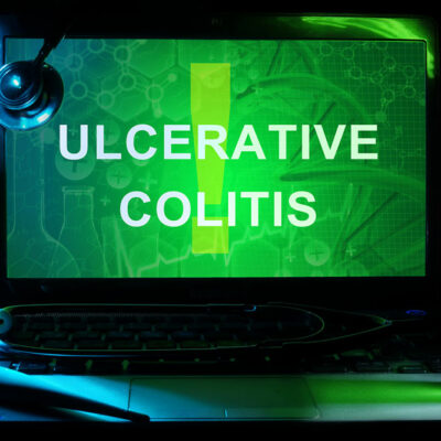 Treatment Options For Ulcerative Colitis
