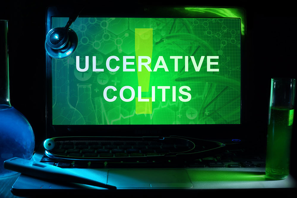 Treatment Options For Ulcerative Colitis