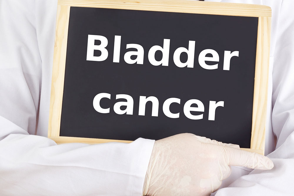Treatments for Bladder Cancer