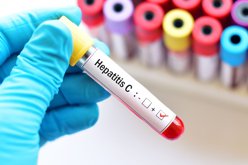 Types of hepatitis and their causes