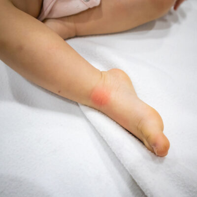 The Causes And Triggers Of Allergic Conditions