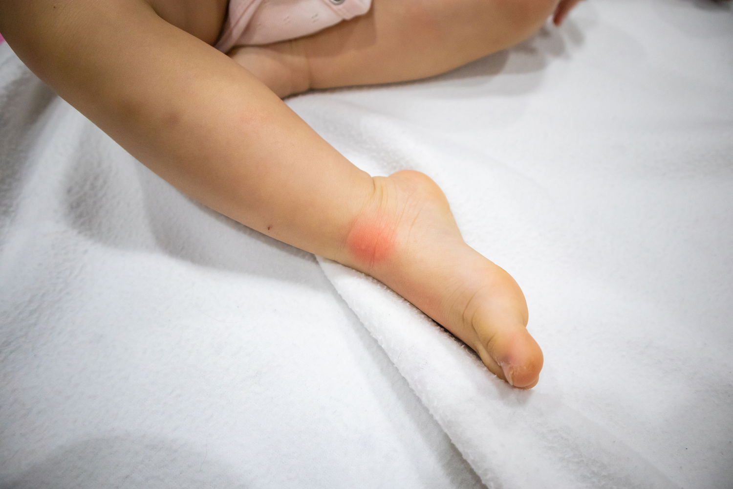 The Causes And Triggers Of Allergic Conditions